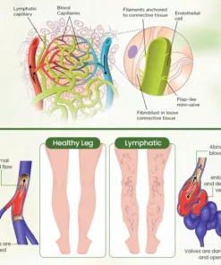 Biancat™ Lymphatic Detox Herbal Cream | Relieves Circulatory Problems in 5 Minutes