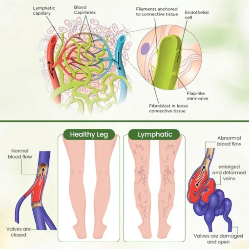 Biancat™ Lymphatic Detox Herbal Cream | Relieves Circulatory Problems in 5 Minutes
