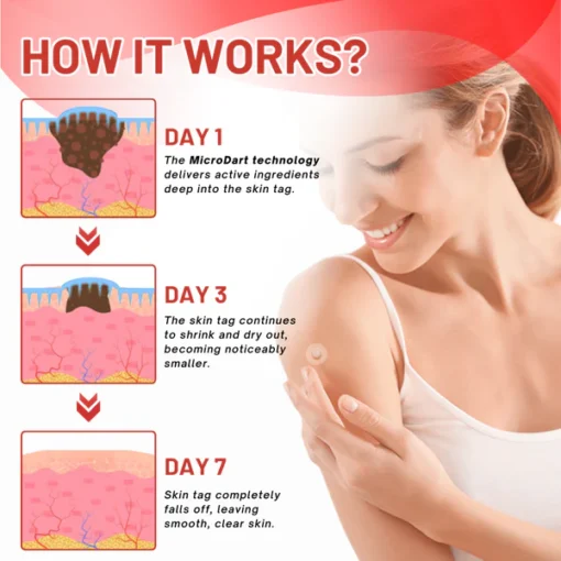 Fivfivgo® MicroDart Skin Tag Remover Patch
