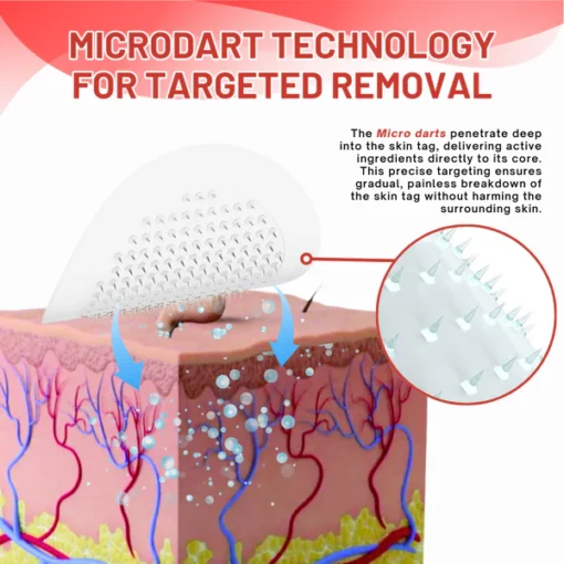 Fivfivgo® MicroDart Skin Tag Remover Patch