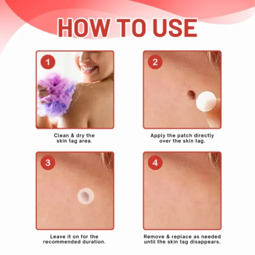 Fivfivgo® MicroDart Skin Tag Remover Patch