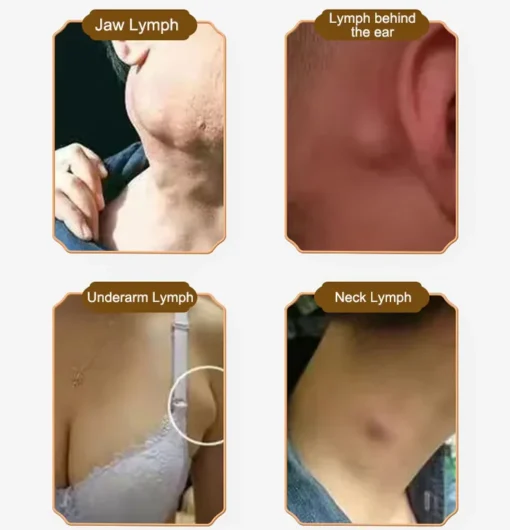 Lymph Care Cream