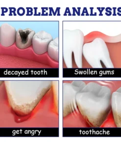 Toothache Relief Spray