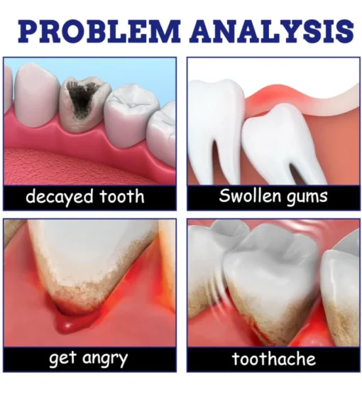 Toothache Relief Spray