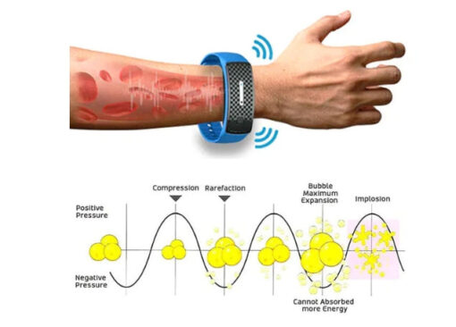Bracciale Snellente a Cavitazione