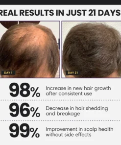 Dafeila® FollicleBoost 5X Hair Growth Serum