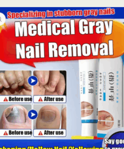 Fungal Nail Treatment Cream