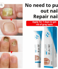 Fungal Nail Treatment Cream